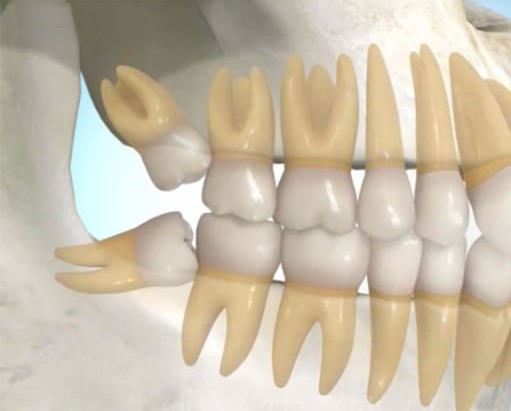 James D. Lussier, DDS — pediatric dentist in Kerrville